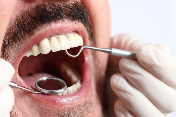 How Important Is It To Get Dental Care For A Chipped Tooth?