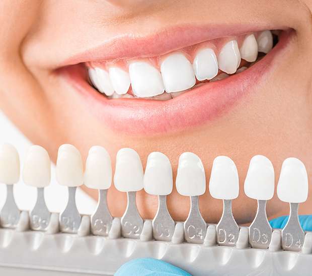Denver Cosmetic Dentist