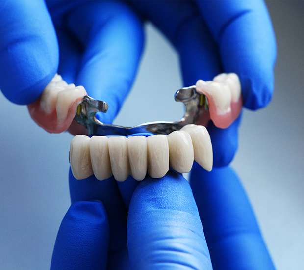 Denver Dental Bridges