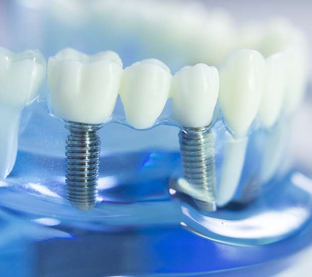 Denver Dental Prosthetics
