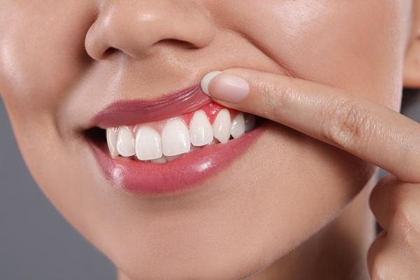 Could Gum Disease Be A Sign Of Another Condition?