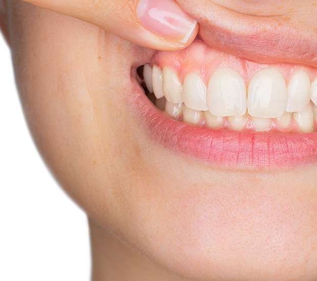 Denver Gum Disease