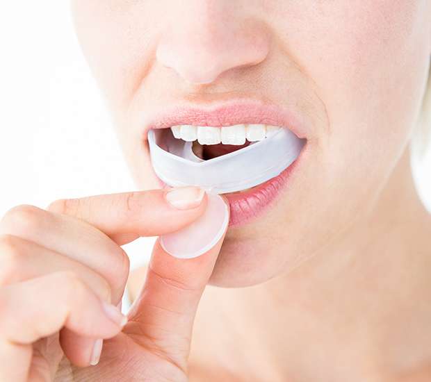 Denver Mouth Guards